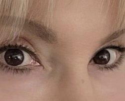Upper Blepharoplasty Before & After Patient #3400
