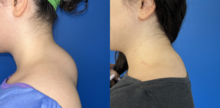 before-after-photo