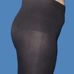Body Contouring Before & After Patient #5346